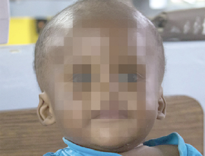 A child diagnosed